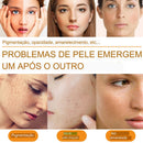 Removedor de Manchas escuras, Soro de vitamina C para clareamento facial