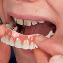 Dentadura de Silicone | Ajustável e Adaptativa